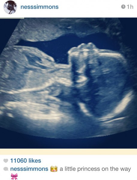 Vanessa-Simmons-sonogram-457x600